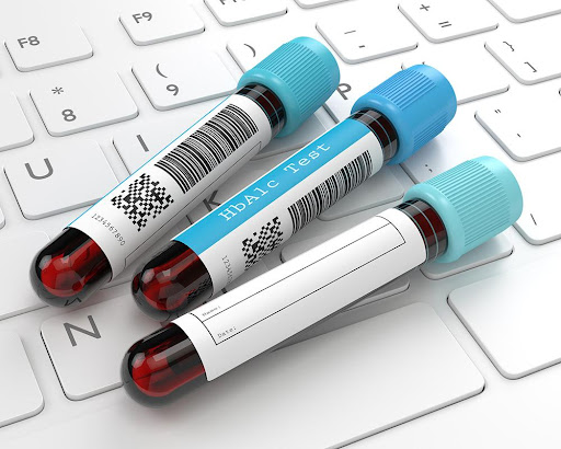 HBA1c-3 Blood Vialsin article