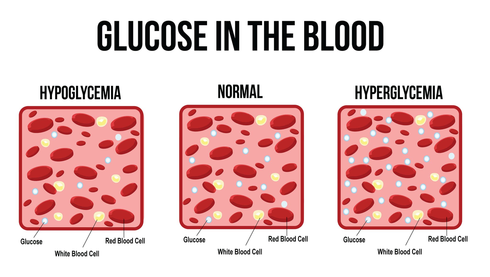 A picture with text reading 'Glucose in the blood' along with images of hypoglycemia, normal and hyperglycemia.