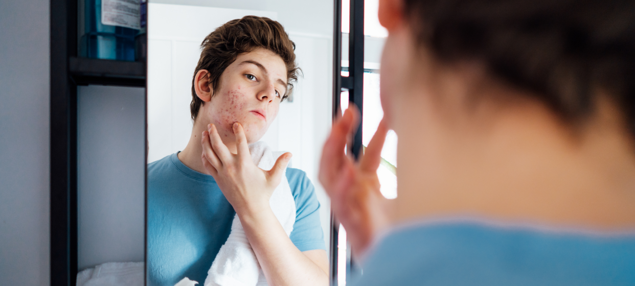 Teen see his face in the mirror